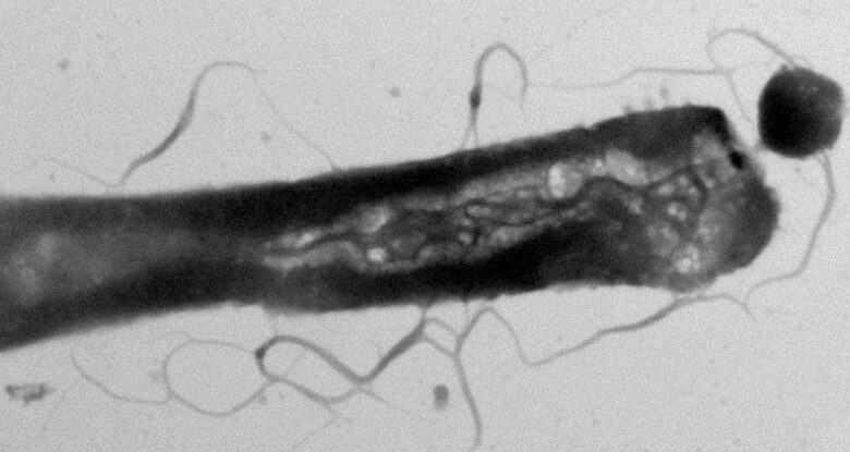 Parasitas 'exigentes' alteram o metabolismo dos hospedeiros ao jantar seletivamente em seu buffet lipídico: ScienceAlert