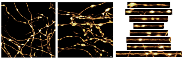 Nanopérolas Vivas