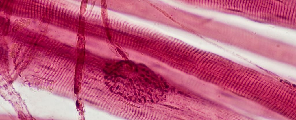 Proteger sua massa muscular é vital para um envelhecimento saudável – Veja o porquê: ScienceAlert