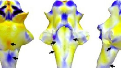 Acabamos de receber mais evidências de que Long COVID é uma lesão cerebral: ScienceAlert