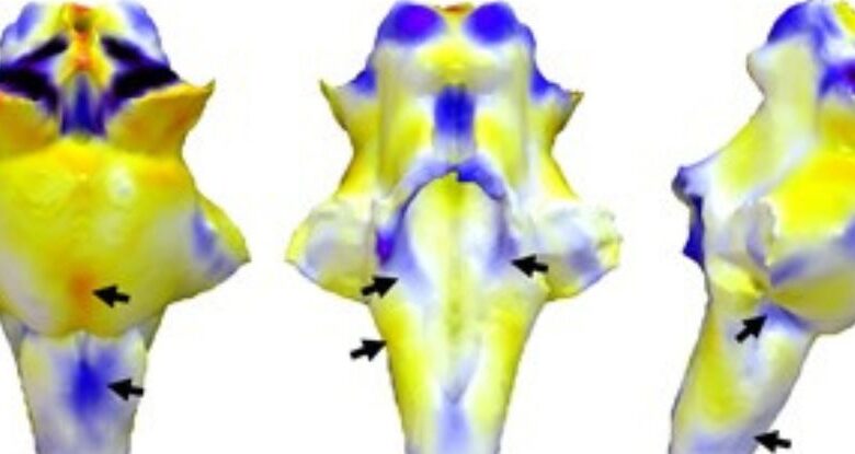 Acabamos de receber mais evidências de que Long COVID é uma lesão cerebral: ScienceAlert