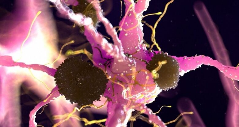 A descoberta de Parkinson sugere que já temos um tratamento aprovado pela FDA: ScienceAlert