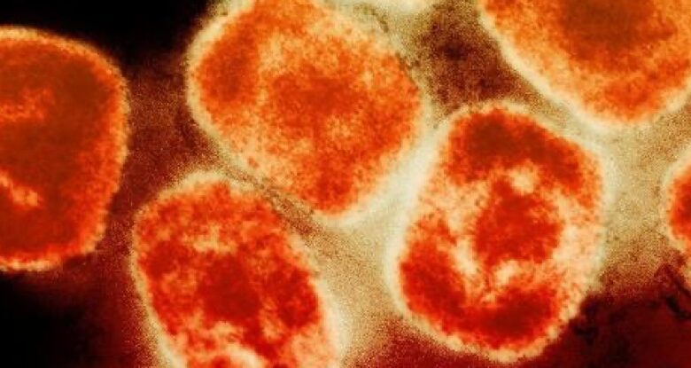 Apenas uma dose de uma vacina existente pode prevenir a infecção por Mpox: ScienceAlert