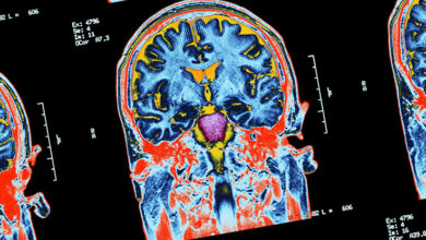 Consciência oculta detectada em 25% dos pacientes que não respondem testados: ScienceAlert