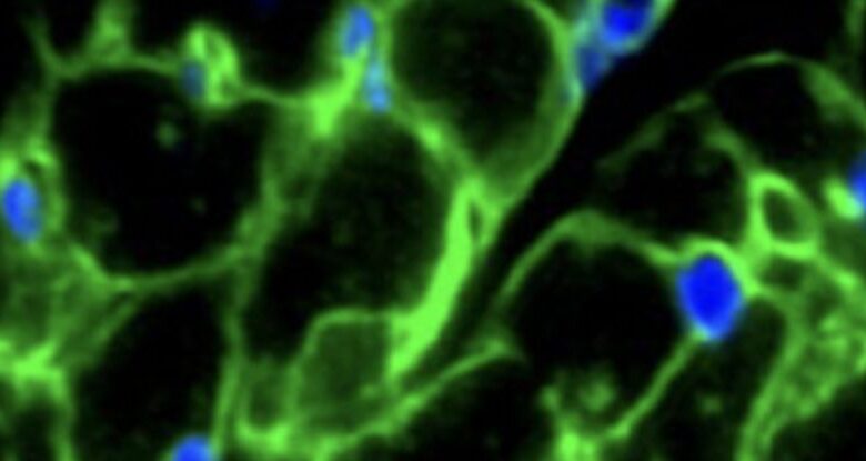 Drogas como o Ozempic podem ter um efeito redutor no coração: ScienceAlert