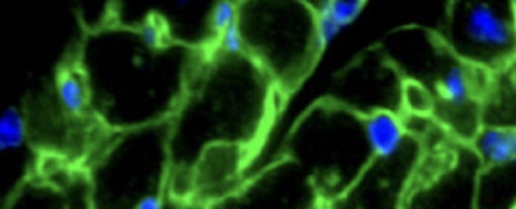 Drogas como o Ozempic podem ter um efeito redutor no coração: ScienceAlert