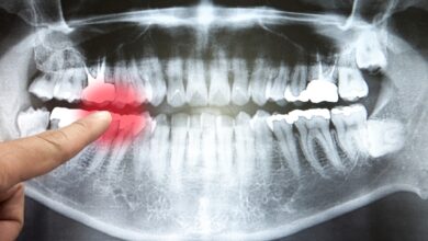 Especialista alerta por que você nunca deve se tornar seu próprio dentista: ScienceAlert