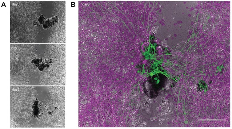 Imagens microscópicas de uma bolha preta fundindo duas paredes de vidro fosco em três painéis e uma teia verde conectando uma lacuna em uma teia rosa