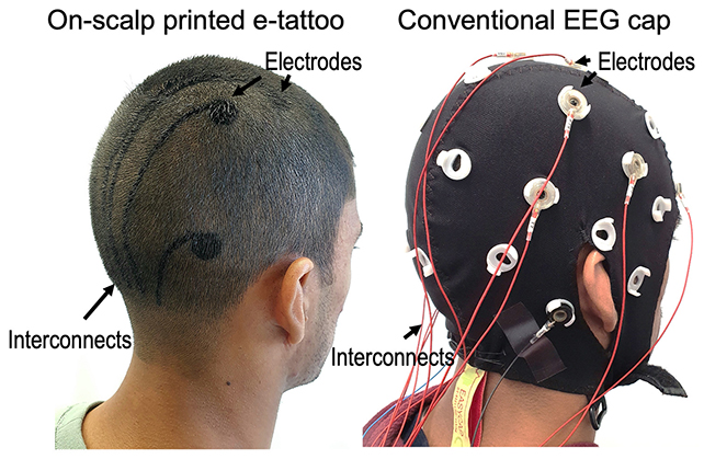 Antes e depois