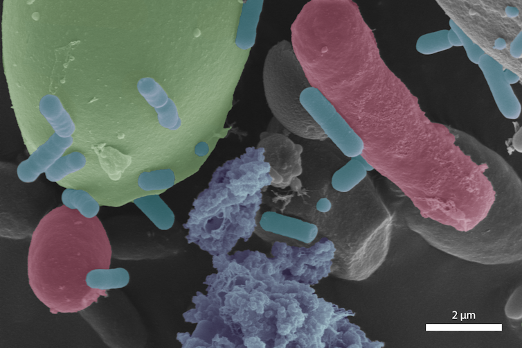 Imagem microscópica de bactérias em forma de bastonete, leveduras alongadas e esféricas e grãos globulares de amido