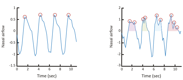 gráfico de inalações anosmicas versus normósmicas