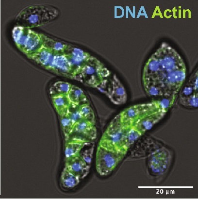 células de amebídio coradas para mostrar F-actina (verde, a maior parte do corpo do protista) e DNA (azul, manchas intermitentes por todo o corpo). 