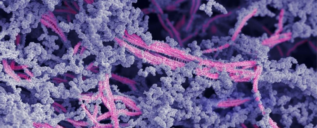 Novo biomaterial pode finalmente reparar cartilagem danificada em articulações lesionadas: ScienceAlert