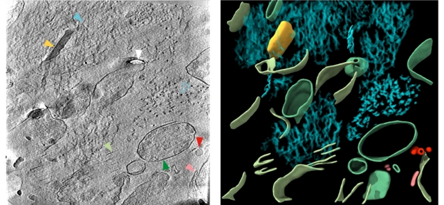 Uma varredura cinza ao lado de uma imagem colorida mostrando moléculas dentro do tecido cerebral