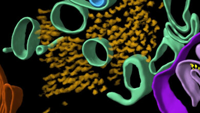 Estrutura molecular 3D dos cérebros de Alzheimer revelados pela primeira vez: Sciencealert