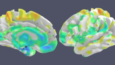 Os cientistas nomeiam o novo tipo de perda de memória frequentemente confundida com Alzheimer: Sciencealert