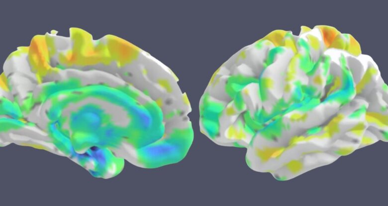 Os cientistas nomeiam o novo tipo de perda de memória frequentemente confundida com Alzheimer: Sciencealert