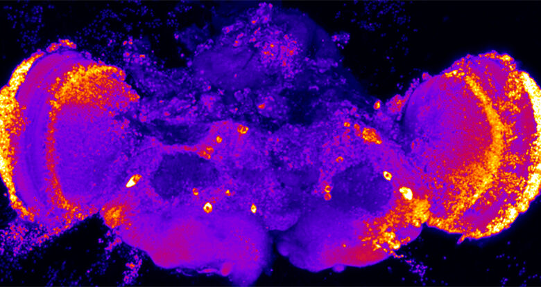 A descoberta de proteínas sugere um novo alvo para as drogas de Alzheimer em estágio inicial: Sciencealert