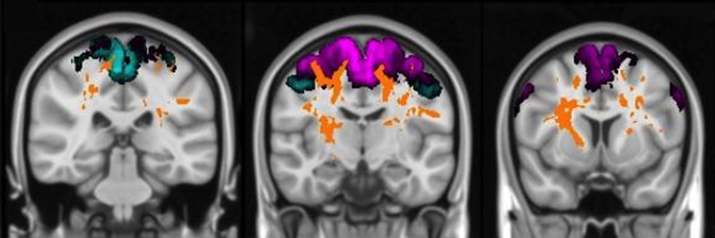 Exames cerebrais