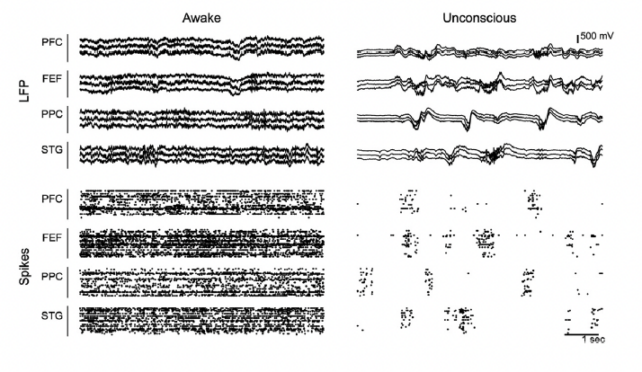 Painel mostrando amostra de dados de atividade cerebral coletados de animais acordados e inconscientes. 