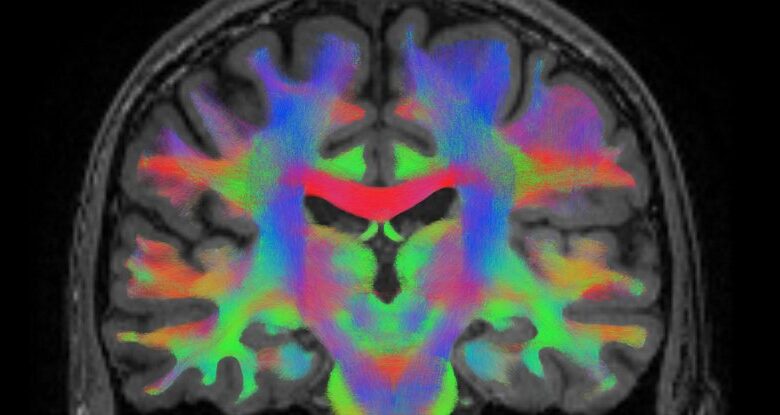 Os cientistas descobrem circuito cerebral que poderia explicar como os placebos facilitam a dor: Sciencealert