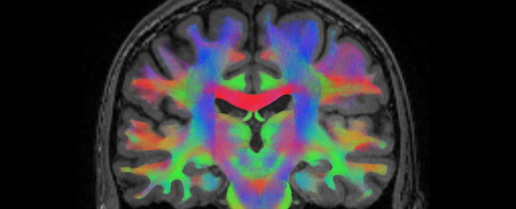 Os cientistas descobrem circuito cerebral que poderia explicar como os placebos facilitam a dor: Sciencealert