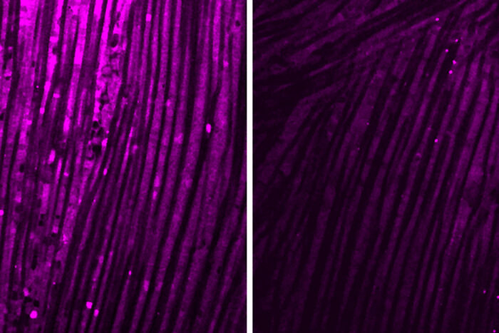 Micrografias de tecido muscular da mosca, lateral esquerdo mais roxo do que o direito